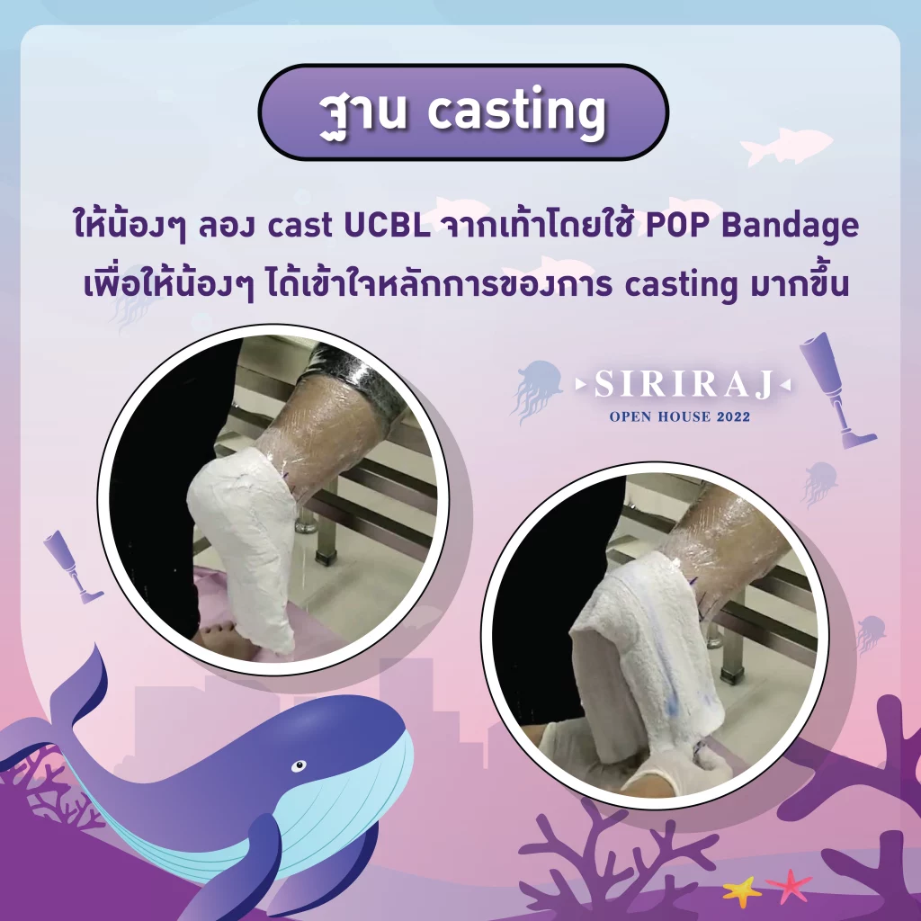ฐาน Casting - ให้น้องๆลอง Cast UCBL จากเท้าโดยใช้ POP Bandage เพื่อให้น้องๆได้เข้าใจหลักการของการ Casting มากขึ้น